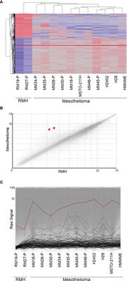 Insulin-Like Growth Factor 2 mRNA Binding Protein 3 Promotes Cell Proliferation of Malignant <mark class="highlighted">Mesothelioma Cells</mark> by Downregulating p27Kip1